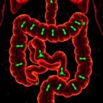 cannabidiol-blocks-colorectal-cancer-spread-via-wnt-pathway