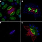 neural-stem-cell-exosomes-alleviate-mptp-induced-parkinson’s