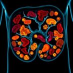 curcumin-shields-microenvironment-to-block-colon-cancer-metastasis