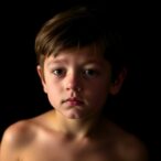 psychological-gains-from-gnrha-and-rhgh-in-precocious-puberty