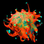 mantle-cell-lymphoma-translocations-rewire-chromosome-wide-gene-expression