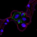 notch2-enhances-granulosa-cell-function-in-ovarian-failure