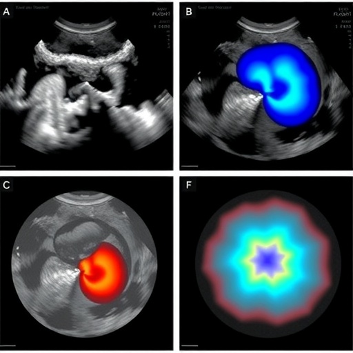 3d-ultrasound-predicts-ovarian-response-in-ivf