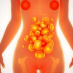 oxidative-stress-and-inflammation-in-pcos:-study-insights