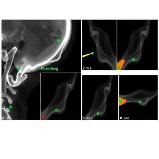 deep-learning-classifies-mandibular-condyle-variations-in-radiographs