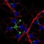 vhl-inhibits-angiogenesis-via-hif-1a-in-macrophages