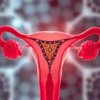 revitalizing-endometrial-stem-cells-for-intrauterine-adhesions