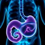 pediatric-biliary-dilatation:-insights-from-multicenter-study