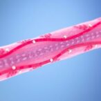 advancements-in-tissue-engineered-vascular-grafts
