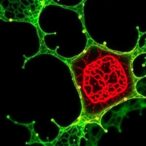 ecm-nanostructures-influence-intestinal-epithelial-cell-differentiation