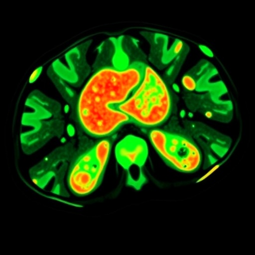 predicting-hodgkin’s-lymphoma-response-with-18fdg-pet/ct