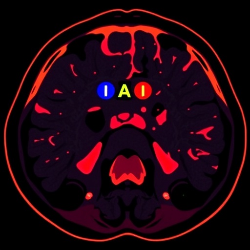 predicting-hodgkin-lymphoma-response-with-pet/ct-radiomics