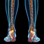 microspheres-combat-osteoporosis-by-targeting-inflammation