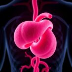 remnant-cholesterol-linked-to-diabetes-risk-factors
