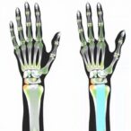advanced-detection-of-upper-limb-motor-intentions