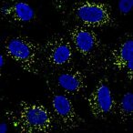 prior-dengue-infection-rewires-immunity,-boosts-vaccine-response
