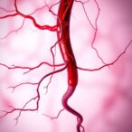 preduodenal-portal-vein:-diverse-cases-and-surgery-insights
