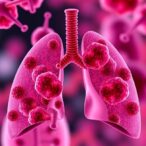new-study-reveals-circulating-tumor-dna-could-guide-immunotherapy-in-limited-stage-sclc
