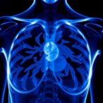 targeted-intraoperative-radiotherapy-advances-in-early-breast-cancer