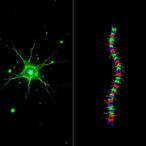 scientists-identify-astrocytic-“brake”-that-inhibits-spinal-cord-repair