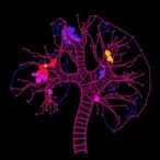 new-study-uncovers-hidden-risks-following-cervical-cancer