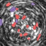 brain-region-identified-as-“dial”-that-can-amplify-or-repress-consumption-in-mice