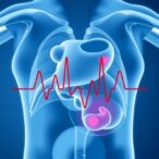 intradialytic-hypotension-and-hemodynamics-after-pediatric-crrt