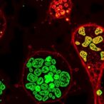 patz1:-key-player-in-tumorigenesis-and-metabolism