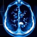 enhancing-pediatric-radiology-education:-our-observership-insights