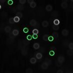 improved-detection-of-fmr1-cgg-repeats-via-novel-assay