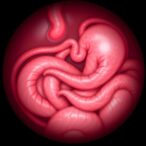 delayed-diagnosis-offers-no-harm-to-intussusception-success