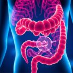 unraveling-gut-microbiota’s-role-in-breast-cancer