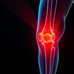 glp-1-drugs-demonstrated-as-cost-effective-treatment-for-knee-osteoarthritis-and-obesity