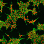 new-hek293-perfusion-a-medium-introduced-for-gene-therapy-production