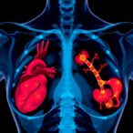 innovative-ai-algorithm-leverages-mammograms-to-precisely-predict-cardiovascular-risk-in-women
