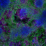 how-spatial-biology-is-unlocking-a-new-dimension-in-cancer-research