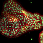 using-human-organoids-to-understand-the-biology-of-exposomes