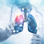 thermo-fisher-rolls-out-biopsy-test-to-better-assess-lung-transplant-rejection-risk