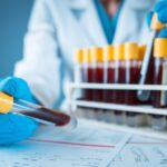 oxford-biodynamics-unveils-new-target-use-for-episwitch-blood-test