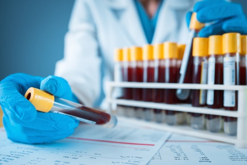 oxford-biodynamics-unveils-new-target-use-for-episwitch-blood-test