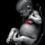 neonate’s-gastric-devascularization:-a-bleeding-case-study