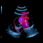 ai-powered-echocardiography-revolutionizes-cardiovascular-disease-care