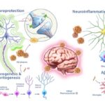 neuroinflammation-a-key-underlying-factor-in-alzheimer’s-disease-risk