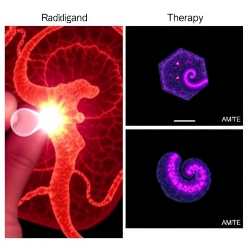 radioligand-therapy’s-impact-on-neuroendocrine-tumors