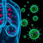 innovative-strategy-to-weaken-cancer-cells-promises-to-boost-prostate-cancer-treatment