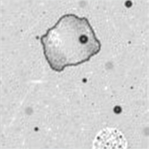 impact-of-storage-time-and-temperature-on-ffpe-proteomics