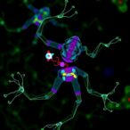 gene-toxin-interaction-triggers-disrupted-sexual-development