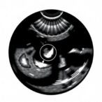 ultrasound-techniques-revolutionize-deep-penetration-volumetric-printing