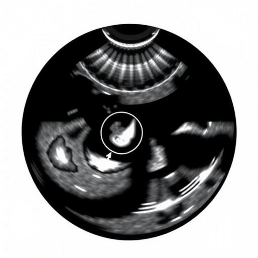 ultrasound-techniques-revolutionize-deep-penetration-volumetric-printing