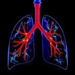 new-clone-3e2-detects-pd-l1-in-lung-cancer